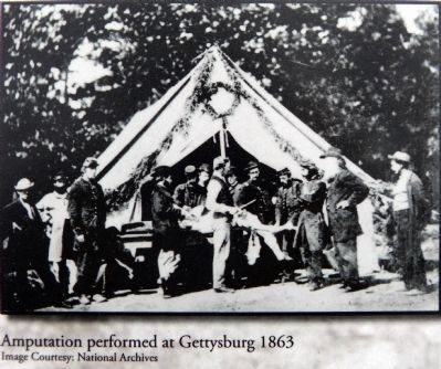 Amputation performed at Gettyburg 1863. Click for full size. Amputation performed at Gettyburg 1863 image. Click for full size.