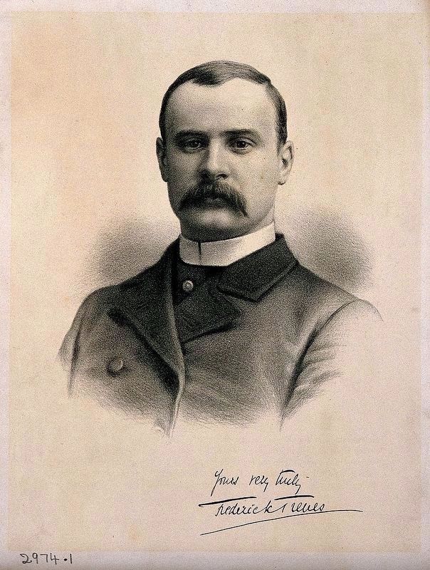 Sir Frederick Treves image. Click for full size.