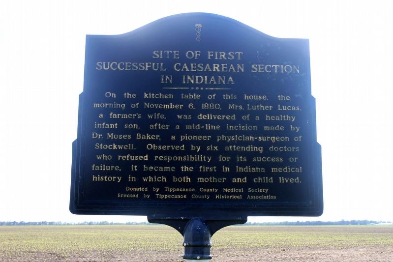 Site Of First Successful Caesarean In Indiana Marker image. Click for full size.