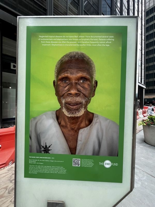 The Blind Chief (Onchocerciasis) - 2022. Click for full size. The Blind Chief (Onchocerciasis) - 2022 image. Click for full size.
