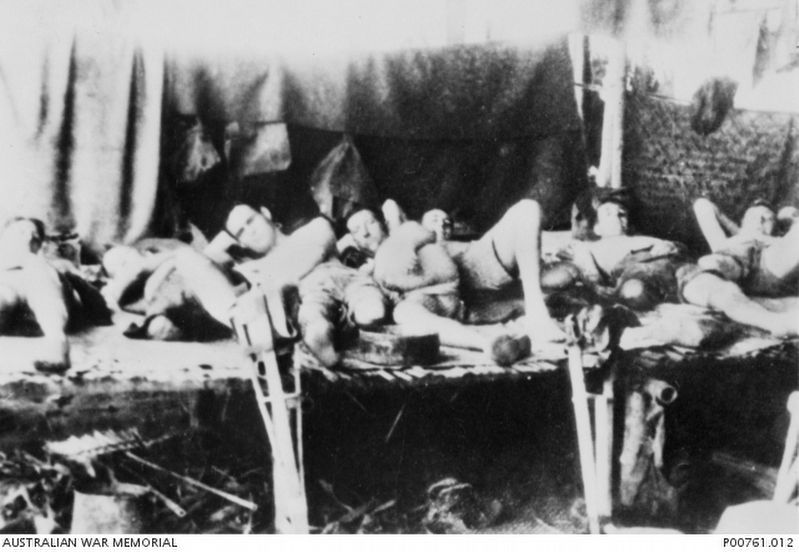 Amputation Ward in a Bamboo Hut Hospital. Click for full size. Amputation Ward in a Bamboo Hut Hospital image. Click for full size.